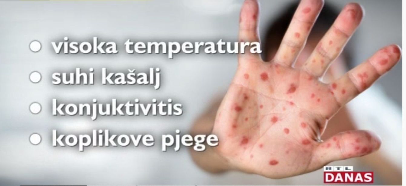 ospice epidemija rtl ospice epidemija rtl