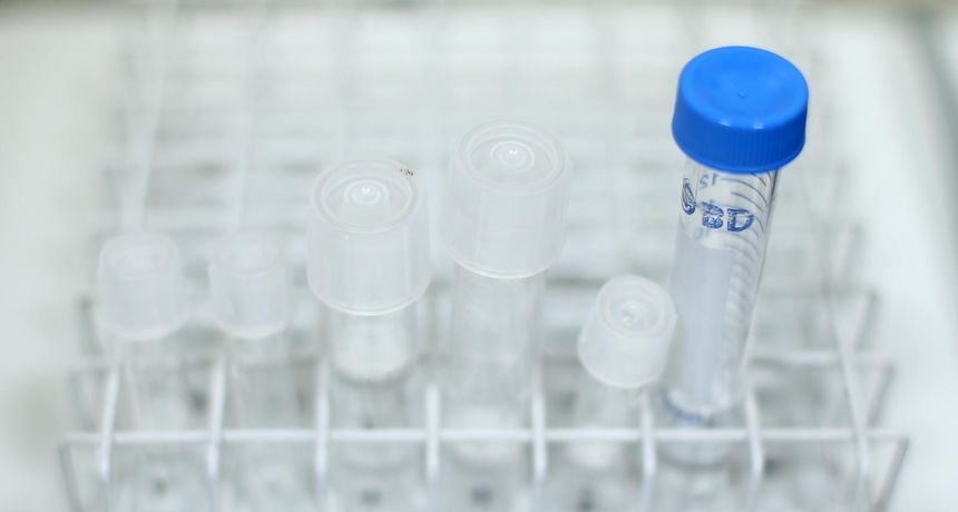 epruveta laboratorij sanjin strukić pixsell epruveta laboratorij sanjin strukić pixsell