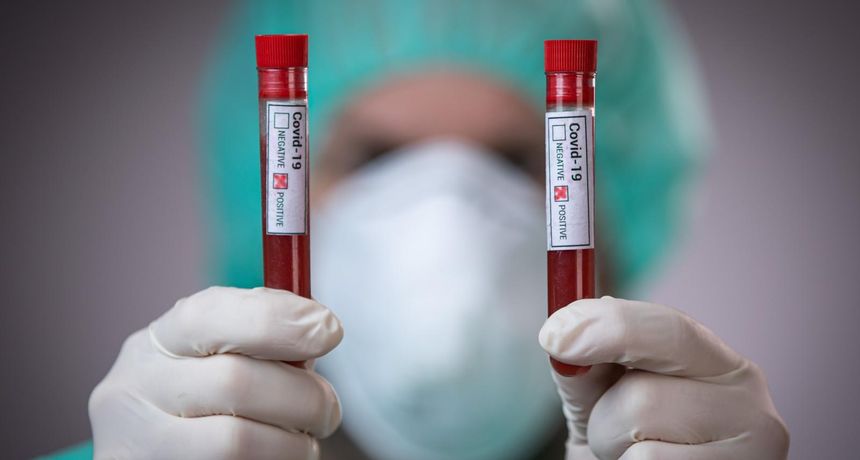 koronavirus covid davor puklavec pixsell