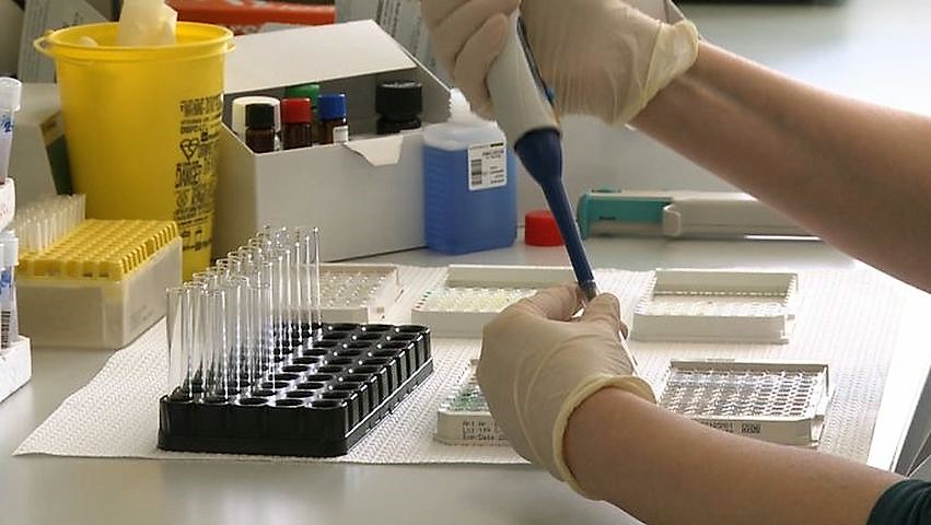 test serološki hrt test serološki hrt