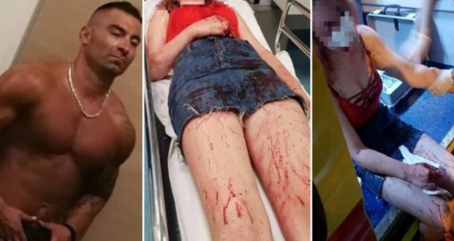 daruvarac žalba ozljede djevojka daruvarac žalba ozljede djevojka