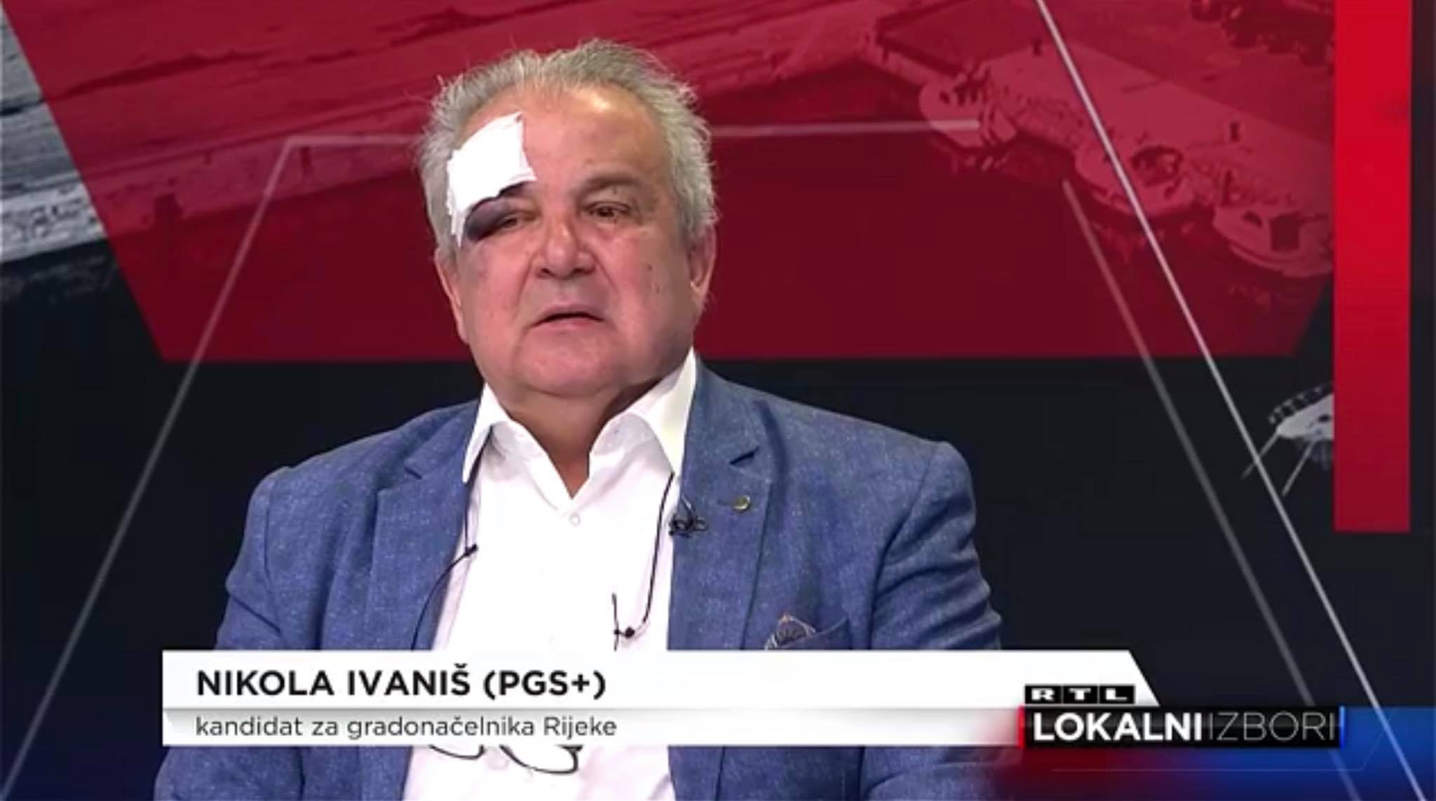 ivaniš zavoj rtl