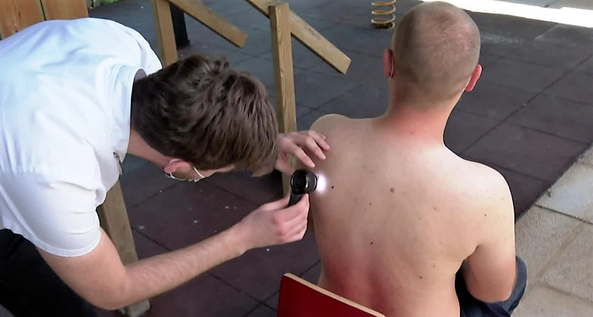 madež pregled rak koža rtl