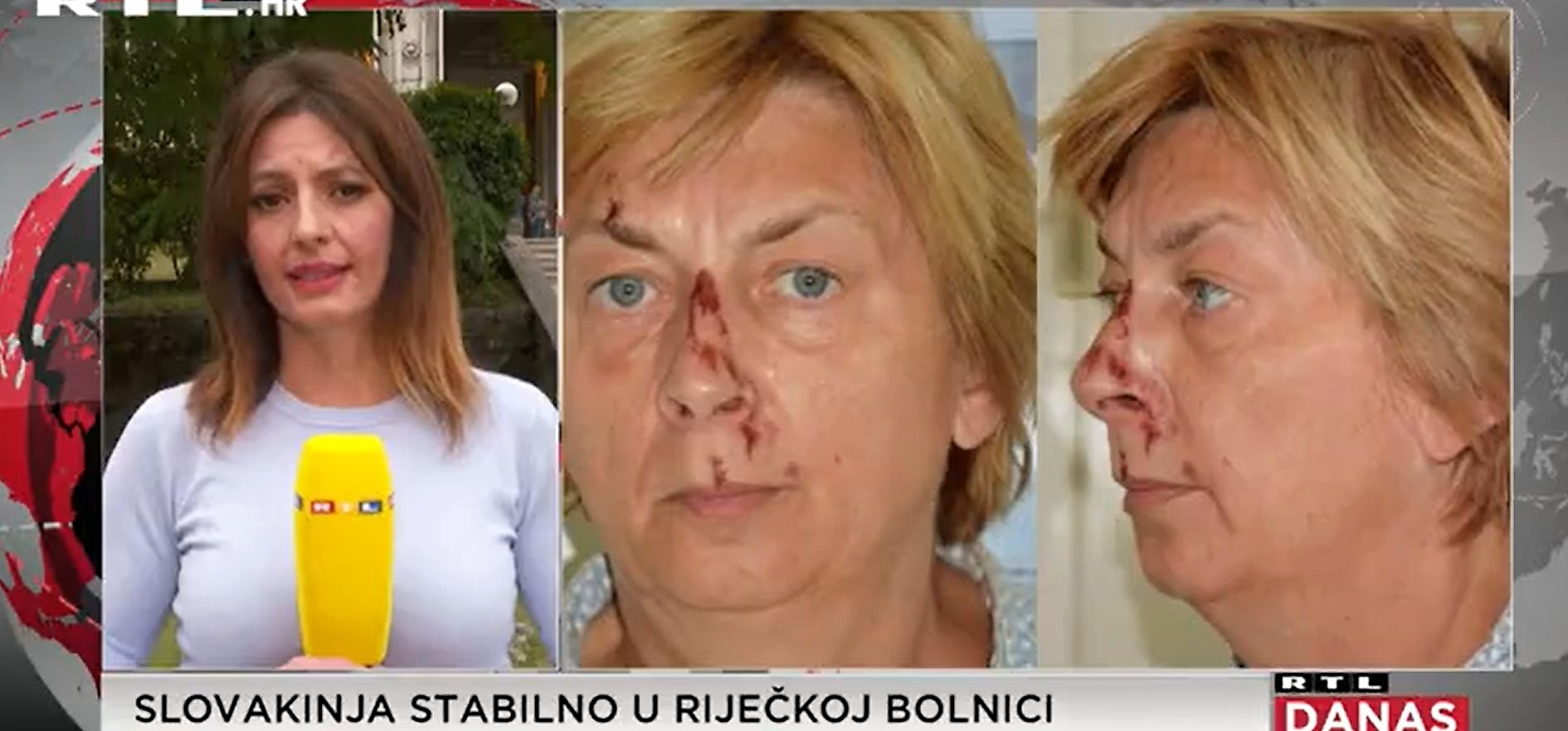 žena bolnica rtl