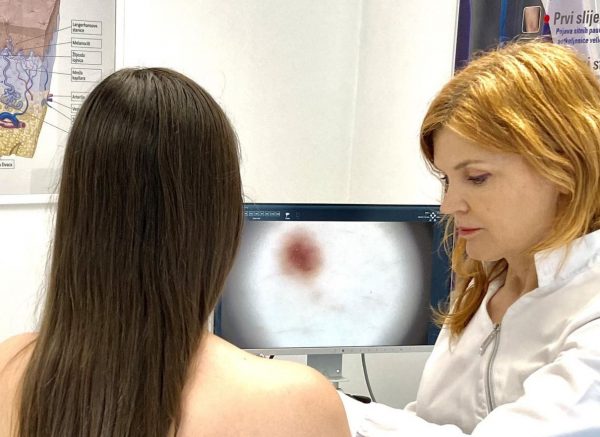 Preglede obavlja specijalistica dermatovenerologije dr. Darinka Periša