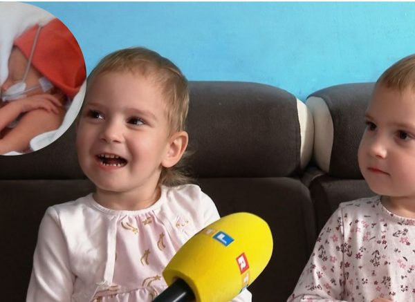 sijamske blizanke