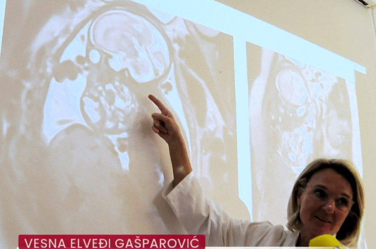 beba tumor rtl